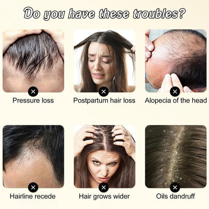 Gingerra™️Ginger Extract Anti-Hairfall Shampoo (Pack of 3)